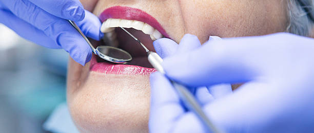 Best Emergency Treatment for Oral Infections in Rosewood Heights, IL